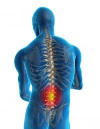 Herniated-Disc-In-Back-1